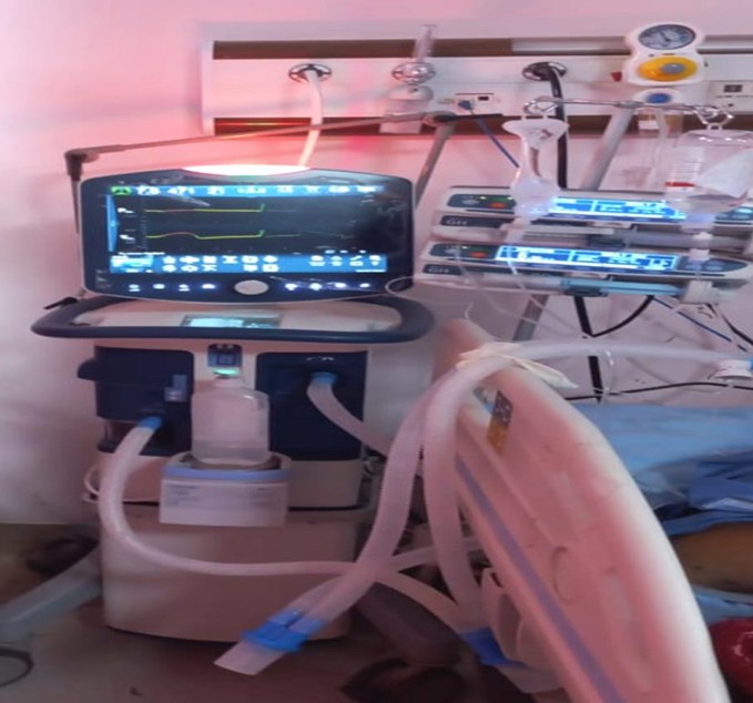 Bennett Mechanical Ventilator